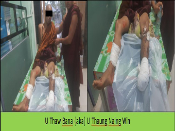 A Buddhist Monk was injured Due to a Mine Detonated by the So-Called PDF Terrorist Group beside a Street In Front of the Nyaungtone Monastery in Chetgyi Village of Kambalu Township