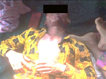 စဉ့်ကူးမြို့နယ်၌ သေနတ်ဖြင့် ပစ်ခတ်ခံရ၍ အမျိုးသား ၂ ဦးသေဆုံးမှု။