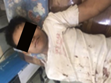 A man was injured by stepping on a mine which exploded in Shwegyin Township.