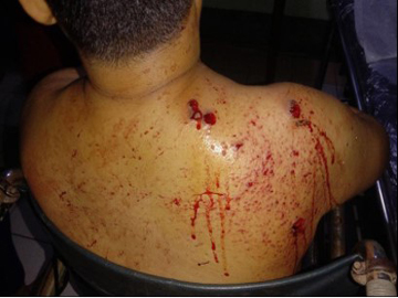 Kawtkhalane Village administrator was injured by the three terrorists’ gunfire in Kyaikemaraw Township.