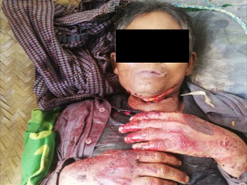 A male was killed in Yaedashe Township.