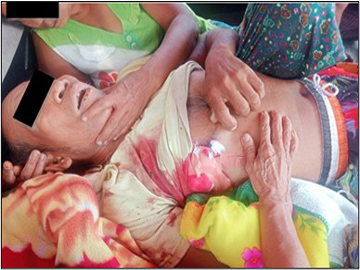 Innocent Civilian Killed in Heavy Weapon Attack by Terrorists in Yebyu Township  of Tanintharyi Region.