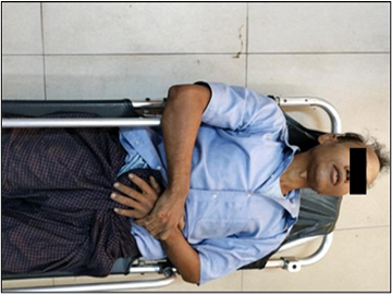 Innocent Civilian Injured After Stepping on Explosive Device Planted by Terrorist Faction  in Sagaing Township of Sagaing Region.