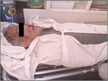 An innocent civilian was shot dead by so-called PDF terrorists in Dawei Township of Tanintharyi Region.