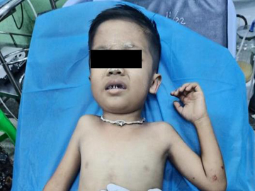 A child was injured after a terrorist faction launched heavy weapons into a village in Patheingyi Township of Mandalay Region.