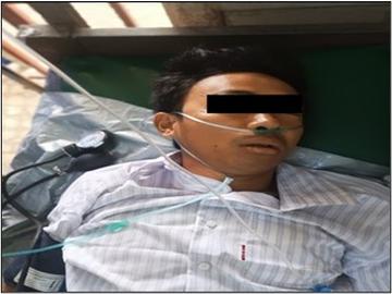 An innocent civilian was injured after stepping on an explosive device planted  by a group of KIA insurgents and so-called PDF terrorists  in Tanaing Township of Kachin State.