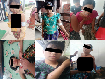မန္တလေးတိုင်းဒေသကြီး၊ မတ္တရာမြို့နယ်၌ PDF အမည်ခံ အကြမ်းဖက်အဖွဲ့က ရပ်ကွက်အတွင်းသို့ လက်နက်ကြီးဖြင့် ပစ်ခတ်တိုက်ခိုက်ခဲ့မှုကြောင့် ကလေးငယ်များအပါအဝင် အပြစ်မဲ့ အရပ်သား ပြည်သူများ သေဆုံး၊ ထိခိုက်ဒဏ်ရာရရှိမှု မှတ်တမ်းဓာတ်ပုံ။