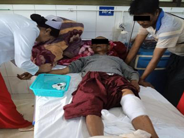 An innocent civilian injured in a heavy weapon attack by a terrorist group in Naungcho Township of Northern Shan State.