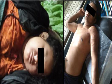 An innocent civilian shot dead and other injured by a group of pro-terrorism KNU members along with so-called PDF terrorists in Nyaunglebin Township of Bago Region.  