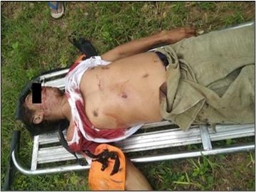 An innocent civilian was shot dead by so-called PDF terrorists in Ayardaw Township of Sagaing Region.