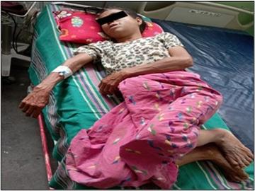 စစ်ကိုင်းတိုင်းဒေသကြီး၊ မြင်းမူမြို့နယ်၊ ခြေရာတော်ကျေးရွာအတွင်းသို့ PDF အမည်ခံ အကြမ်းဖက်သမားများက လက်နက်ကြီးဖြင့် အကြောင်းမဲ့ ပစ်ခတ်ခဲ့မှုကြောင့် အပြစ်မဲ့ အရပ်သားပြည်သူ တစ်ဦး ထိခိုက်ဒဏ်ရာရရှိမှု မှတ်တမ်းဓာတ်ပုံ။