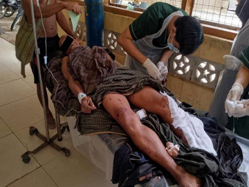 An innocent civilian was injured after stepping on an explosive device planted  by a so-called PDF terrorist group in Sidoktaya Township of Magway Region.