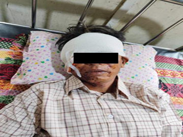   An innocent civilian was injured by explosive device planted by a so-called  PDF terrorist group in Phyu Township of Bago Region.