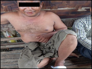 Two innocent civilians injured in an improvised rocket attack by a so-called  PDF terrorist group in Madaya Township of Mandalay Region.