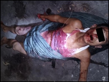 An innocent civilian killed in an IED attack by so-called PDF terrorists  in Taungtha Township of Mandalay Region.