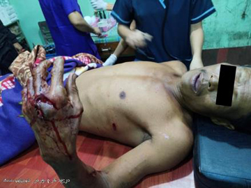 100-household elder injured in an attack by pro-terrorism KNU member  and so-called PDF terrorist in Bilin Township of Mon State.