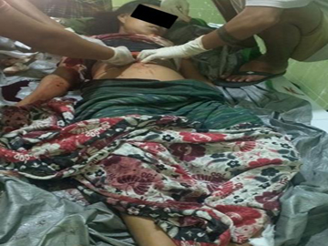 An innocent civilian shot dead by a so-called PDF terrorist group in Myingyan Township of Mandalay Region.