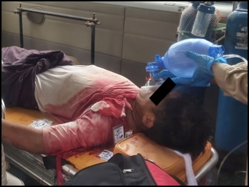 An innocent civilian killed in an improvised rocket attack by a so-called PDF terrorist group in Salingyi Township.