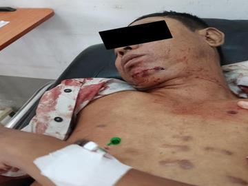 An innocent civilian shot dead by a so-called PDF terrorist group in Gyobingauk Township of Bago Region.