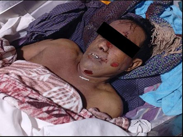 A 100-household elder shot dead by a so-called PDF terrorist group in Taungtha Township of Mandalay Region.