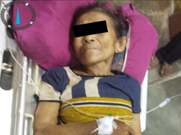 A Woman Injured in Heavy Weapon Attack by Members of the KNU terrorist group and the so-called PDF terrorist group in Kyaikhto Township of Mon State.