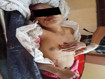 An innocent civilian shot dead by a combined group of KNU and so-called PDF terrorists in Ye Township Of Mon State.