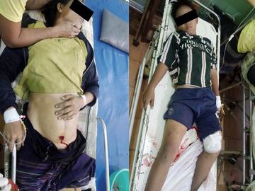 မန္တလေးတိုင်းဒေသကြီး၊ မလှိုင်မြို့နယ်၌ PDF အမည်ခံ အကြမ်းဖက်သမားများက  လက်နက်ကြီးဖြင့် ပစ်ခတ်တိုက်ခိုက်ခဲ့မှုကြောင့် အပြစ်မဲ့ အရပ်သားပြည်သူ နှစ်ဦး ထိခိုက်ဒဏ်ရာရရှိမှု မှတ်တမ်းဓာတ်ပုံ။