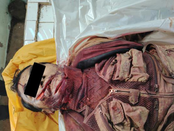 An innocent civilian stabbed  to death by a so-called PDF terrorists   in Ywarngan Township of Shan State.