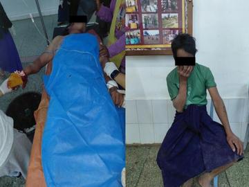 ကယားပြည်နယ်၊ လွိုင်ကော်မြို့နယ်၌ PDF အမည်ခံ အကြမ်းဖက်သမားများ ထောင်ထားသည့်  မိုင်း တစ်လုံးအား လယ်ထွန်စက်ဘီးဖြင့် ကြိတ်မိပေါက်ကွဲခဲ့မှုကြောင့် အပြစ်မဲ့  အရပ်သားပြည်သူ နှစ်ဦး ထိခိုက်ဒဏ်ရာရရှိမှု မှတ်တမ်းဓာတ်ပုံ။