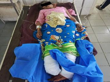   ကချင်ပြည်နယ်၊ မိုးညှင်းမြို့နယ်၌ KIA သောင်းကျန်းသူအဖွဲ့နှင့် PDF အမည်ခံ အကြမ်းဖက်  သမားများ ပူးပေါင်းအဖွဲ့ ထောင်ထားသည့် နင်းမိုင်း တစ်လုံးအား နင်းမိပေါက်ကွဲခဲ့မှုကြောင့်  အပြစ်မဲ့ အရပ်သား ပြည်သူ တစ်ဦး ထိခိုက်ဒဏ်ရာရရှိမှု မှတ်တမ်းဓာတ်ပုံ။