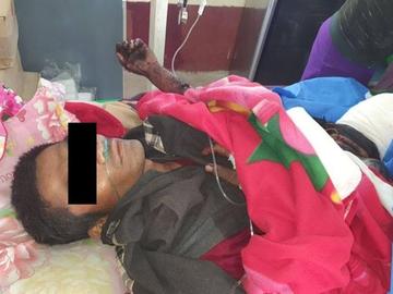 ရှမ်းပြည်နယ်၊ နောင်ချိုမြို့နယ်၌ TNLA အကြမ်းဖက်အဖွဲ့ထောင်ထားသည့် မိုင်း တစ်လုံးအား နင်းမိ ပေါက်ကွဲခဲ့မှုကြောင့် အပြစ်မဲ့ အရပ်သားပြည်သူ တစ်ဦး ထိခိုက်ဒဏ်ရာရရှိမှု မှတ်တမ်းဓာတ်ပုံ။