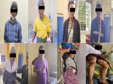 Five man and three women injured after stepping on four landmines planted by  so-called PDF terrorists in Salin Township of Magway Region.