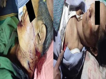 မကွေးတိုင်းဒေသကြီး၊ တောင်တွင်းကြီးမြို့နယ်၌ PDF အမည်ခံ အကြမ်းဖက်သမားများက  သေနတ်ဖြင့် ပစ်ခတ်သတ်ဖြတ်ခဲ့မှုကြောင့် အပြစ်မဲ့ အရပ်သားပြည်သူ  နှစ်ဦး သေဆုံးမှု မှတ်တမ်းဓာတ်ပုံ။