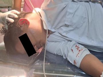 မန္တလေးတိုင်းဒေသကြီး၊ မလှိုင်မြို့နယ်၌ PDF အမည်ခံ အကြမ်းဖက်သမားများက  Drone ဖြင့် Drop Bomb များ ပစ်ချတိုက်ခိုက်ခဲ့မှုကြောင့် နိုင်ငံ့ဝန်ထမ်း တစ်ဦး  ထိခိုက်ဒဏ်ရာရရှိမှု မှတ်တမ်းဓာတ်ပုံ။