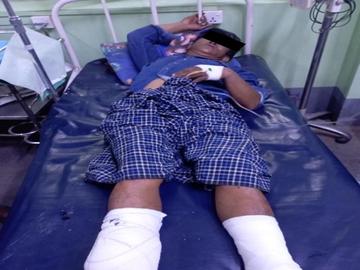 An innocent civilian injured after stepping on an improvised explosive device  planted by so-called PDF terrorists in Madaya Township of Mandalay Region.