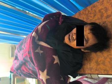 An innocent civilian killed after stepping on an improvised explosive device  planted by so-called PDF terrorists in Loikaw Township of Kayah State.