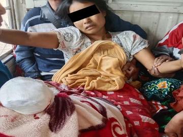 An innocent civilian injured after stepping on an improvised explosive device planted by  so-called PDF terrorists in Kyunhla Township of Sagaing Region.