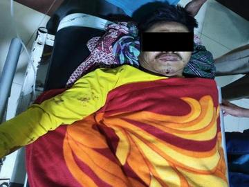 ရှမ်းပြည်နယ်၊ နောင်ချိုမြို့နယ်၌ TNLA အကြမ်းဖက်အဖွဲ့များ ထောင်ထားသည့်   နင်းမိုင်း တစ်လုံးအား နင်းမိပေါက်ကွဲခဲ့မှုကြောင့် အပြစ်မဲ့ အရပ်သားပြည်သူ တစ်ဦး   ထိခိုက်ဒဏ်ရာရရှိမှု မှတ်တမ်းဓာတ်ပုံ။