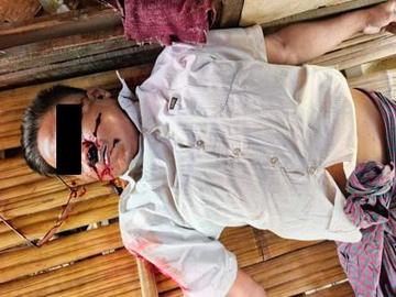 ပဲခူးတိုင်းဒေသကြီး၊ ဖြူးမြို့နယ်၌ PDF အမည်ခံ အကြမ်းဖက်သမားများက သေနတ်ဖြင့် ပစ်ခတ်သတ်ဖြတ်ခဲ့မှုကြောင့် အပြစ်မဲ့ အရပ်သားပြည်သူ တစ်ဦး သေဆုံးမှု မှတ်တမ်းဓာတ်ပုံ။