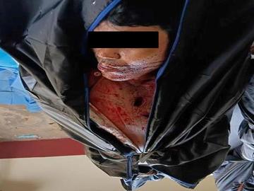 တနင်္သာရီတိုင်းဒေသကြီး၊ သရက်ချောင်းမြို့နယ်၌ PDF အမည်ခံ အကြမ်းဖက်သမားများက သေနတ်ဖြင့် ပစ်ခတ်သတ်ဖြတ်ခဲ့မှုကြောင့် အပြစ်မဲ့ အရပ်သားပြည်သူ တစ်ဦး  သေဆုံးမှု မှတ်တမ်းဓာတ်ပုံ။