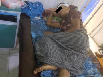 Man injured in a drone attack by so-called PDF terrorists in Ngazun Township of Mandalay Region.