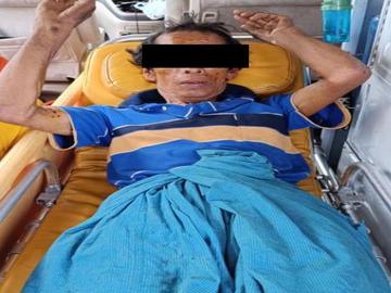 An innocent civilian injured in a heavy weapon attack by so-called PDF terrorists in Thayetchaung Township of Tanintharyi Region.