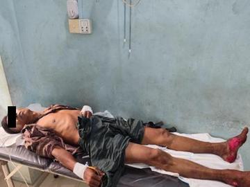 An innocent civilian injured in an improvised exploded device planted by so-called  PDF terrorists in Chauk Township.