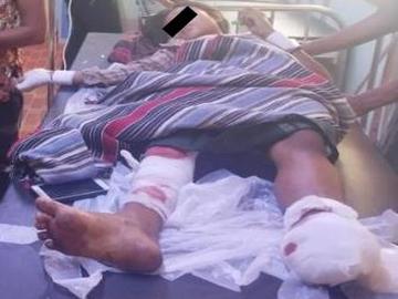 Child injured in an improvised explosive device explosion in Pwintphyu Township of Magway Region.