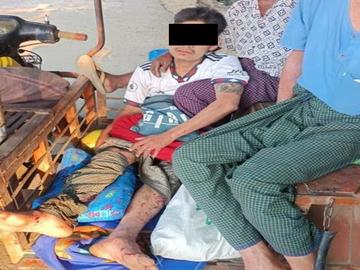 ပဲခူးတိုင်းဒေသကြီး၊ ကျောက်ကြီးမြို့နယ်၌ လက်နက်ကိုင် အကြမ်းဖက်အဖွဲ့များ ထောင်ထားသည့် နင်းမိုင်း တစ်လုံးအား နင်းမိပေါက်ကွဲခဲ့မှုကြောင့် အပြစ်မဲ့  အရပ်သားပြည်သူ တစ်ဦး ထိခိုက်ဒဏ်ရာရရှိမှု မှတ်တမ်းဓာတ်ပုံ။