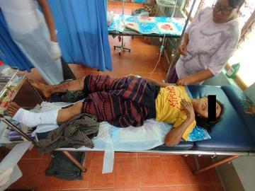 An innocent civilian injured in an improvised explosive device planted by so-called  PDF terrorists in Madaya Township of Mandalay Region.