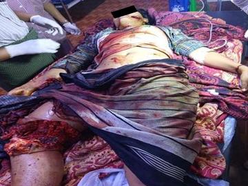 An innocent civilian killed in a heavy weapon attack by so-called PDF terrorists in Pwintphyu Township of Magway Region.  