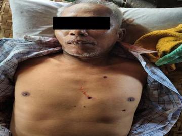 မွန်ပြည်နယ်၊ ဘီးလင်းမြို့နယ်၌ KNU အကြမ်းဖက်အဖွဲ့နှင့် PDF အမည်ခံ အကြမ်းဖက်သမားများ  ပူးပေါင်းအဖွဲ့က သေနတ်ဖြင့် ပစ်ခတ်သတ်ဖြတ်ခဲ့မှုကြောင့် အမျိုးသား တစ်ဦး သေဆုံးမှု မှတ်တမ်းဓာတ်ပုံ။