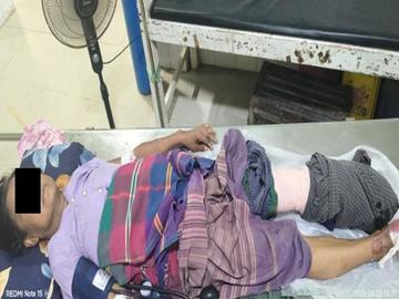 မကွေးတိုင်းဒေသကြီး၊ စလင်းမြို့နယ်၌ PDF အမည်ခံ အကြမ်းဖက်သမားများ ထောင်ထားသည့် နင်းမိုင်း တစ်လုံးအား နင်းမိပေါက်ကွဲခဲ့မှုကြောင့် အပြစ်မဲ့ အရပ်သားပြည်သူ တစ်ဦး ထိခိုက်ဒဏ်ရာရရှိမှု မှတ်တမ်းဓာတ်ပုံ။