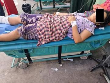 An innocent civilian injured in an improvised explosive device explosion in Myingyan Township of Mandalay Region.